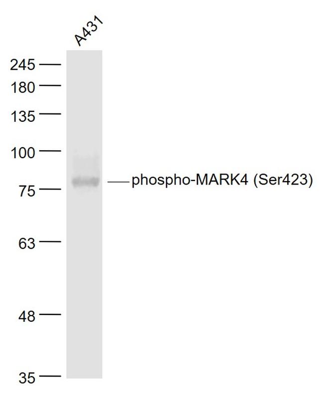 Phospho-MARK4 (Ser423) Antibody in Western Blot (WB)