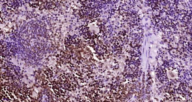 CD161c/NK1.1 Antibody in Immunohistochemistry (Paraffin) (IHC (P))