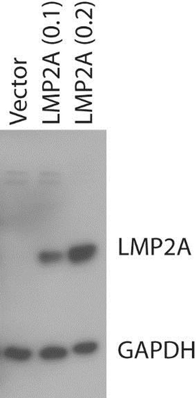 EBV LMP2 Antibody in Western Blot (WB)