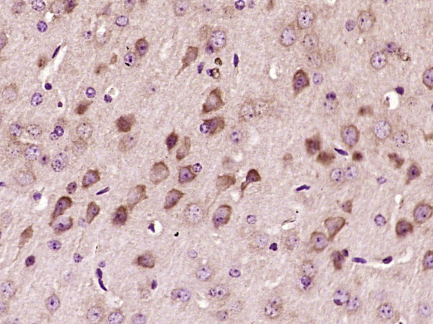 VWF Antibody in Immunohistochemistry (Paraffin) (IHC (P))