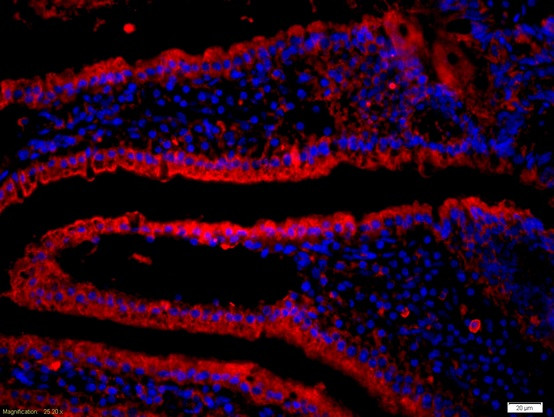 CD19 Antibody in Immunohistochemistry (Paraffin) (IHC (P))