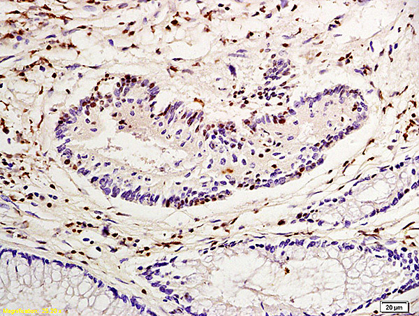 Nucleophosmin Antibody in Immunohistochemistry (Paraffin) (IHC (P))