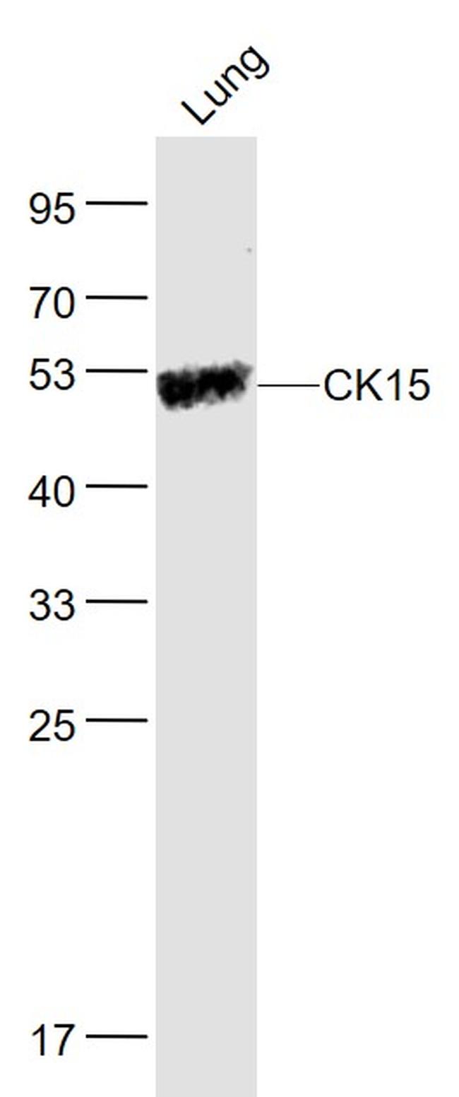 CK15 Antibody in Western Blot (WB)