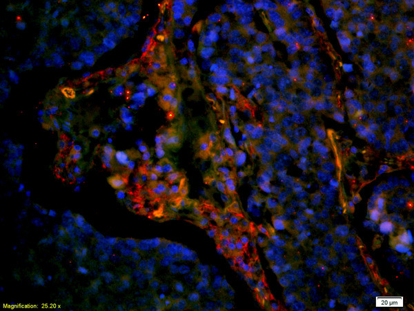 CD8 Antibody in Immunohistochemistry (Paraffin) (IHC (P))
