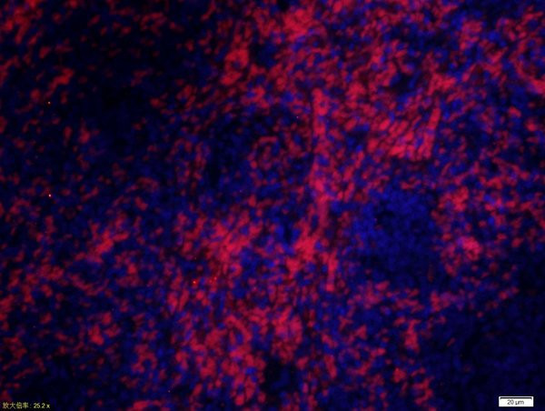 CD8 alpha Antibody in Immunohistochemistry (Paraffin) (IHC (P))