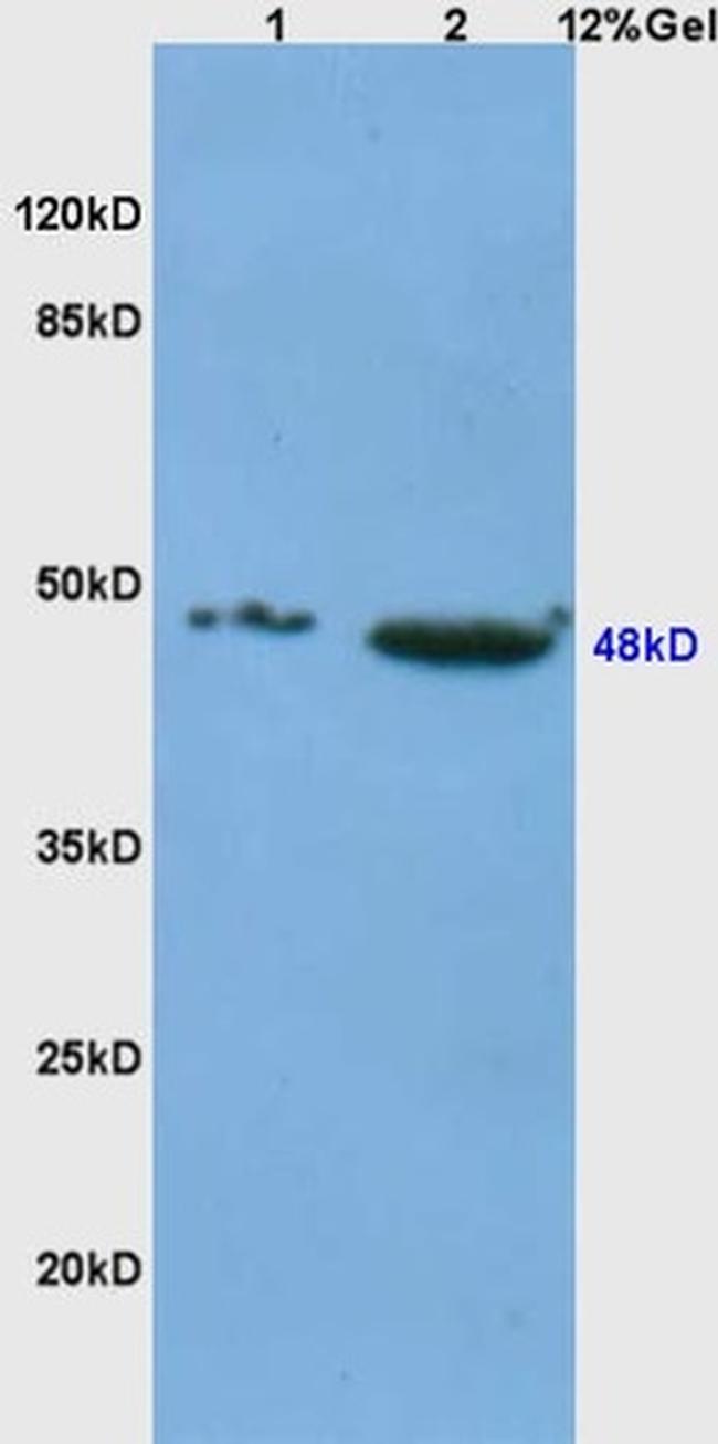 CD4 Antibody in Western Blot (WB)