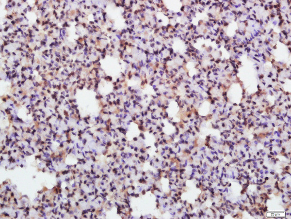 Phospho-eIF2 alpha subunit 1 (Ser52) Antibody in Immunohistochemistry (Paraffin) (IHC (P))