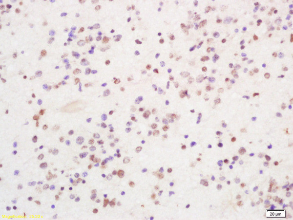 PIRH2 Antibody in Immunohistochemistry (Paraffin) (IHC (P))