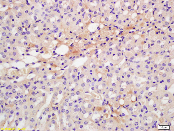 CXCR7/RDC1 Antibody in Immunohistochemistry (Paraffin) (IHC (P))