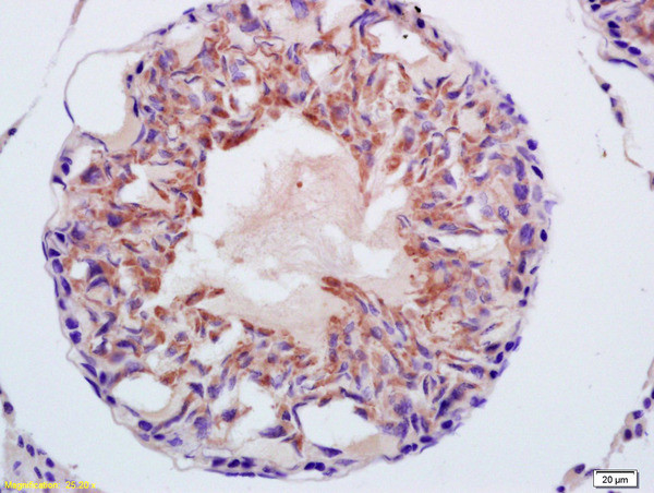 CITED1/ABCC1 Antibody in Immunohistochemistry (Paraffin) (IHC (P))