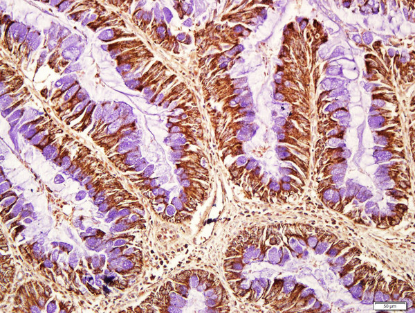 CD8B Antibody in Immunohistochemistry (Paraffin) (IHC (P))