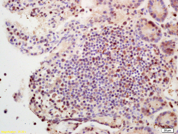SETBP1 Antibody in Immunohistochemistry (Paraffin) (IHC (P))