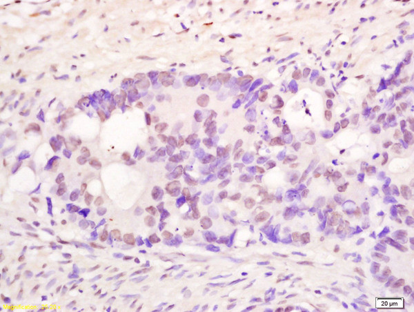 PMS1 Antibody in Immunohistochemistry (Paraffin) (IHC (P))