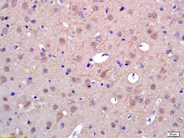 PAPOA Antibody in Immunohistochemistry (Paraffin) (IHC (P))