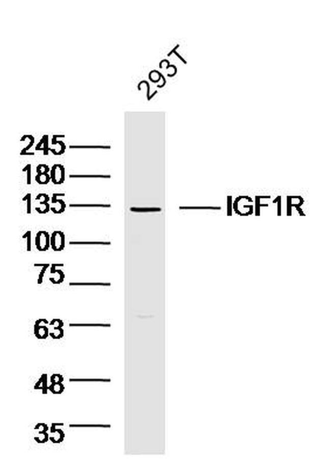 IGF1R Antibody in Western Blot (WB)