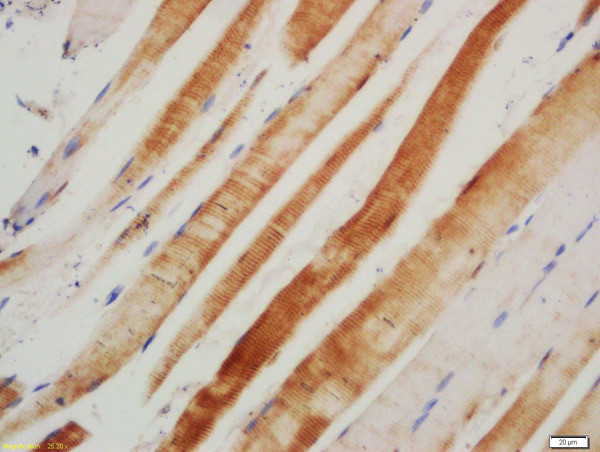 AGER Antibody in Immunohistochemistry (Paraffin) (IHC (P))