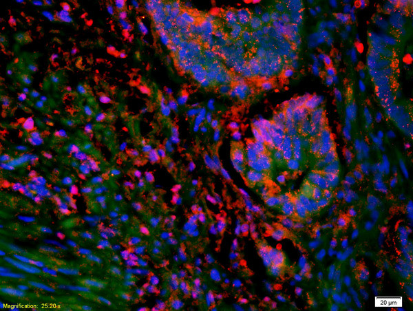 SOAT2 Antibody in Immunohistochemistry (Paraffin) (IHC (P))