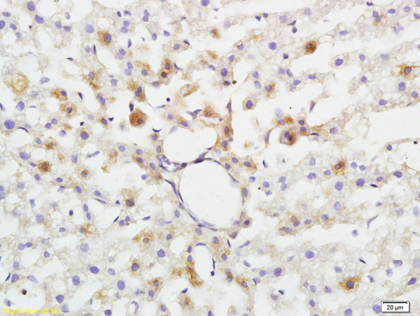 ABHD5 Antibody in Immunohistochemistry (Paraffin) (IHC (P))