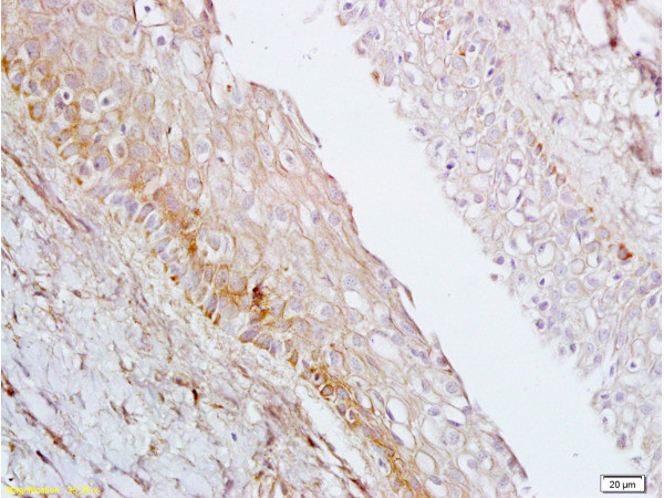 AGPAT4 Antibody in Immunohistochemistry (Paraffin) (IHC (P))
