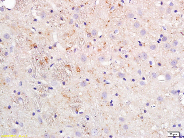 ApoE Antibody in Immunohistochemistry (Paraffin) (IHC (P))