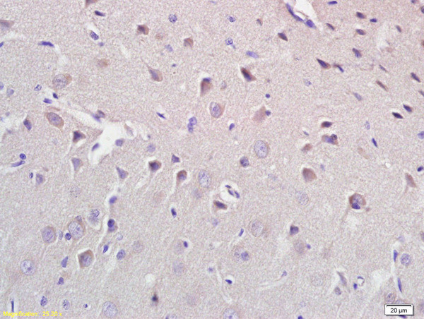 CROT Antibody in Immunohistochemistry (Paraffin) (IHC (P))