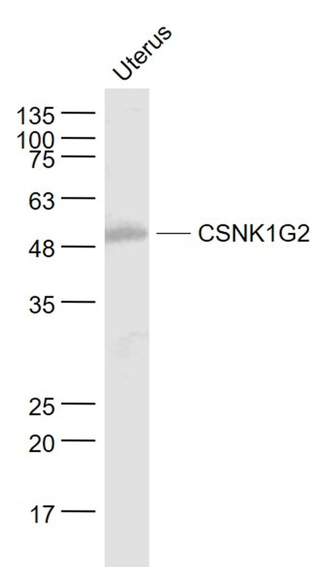 CSNK1G2 Antibody in Western Blot (WB)