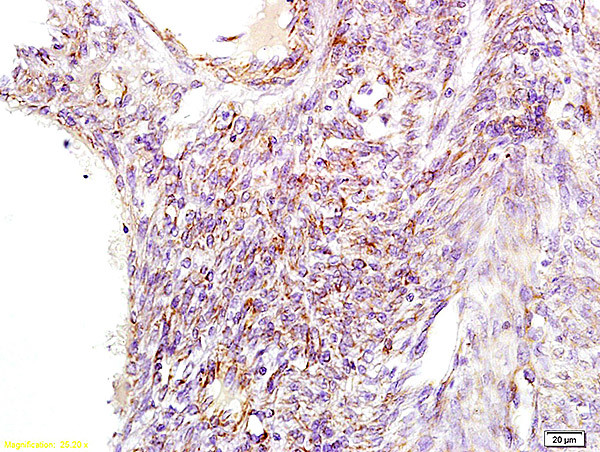 GNPAT Antibody in Immunohistochemistry (Paraffin) (IHC (P))