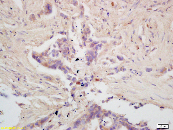 GPAM Antibody in Immunohistochemistry (Paraffin) (IHC (P))