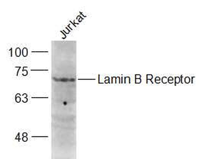 Lamin B Receptor Antibody in Western Blot (WB)