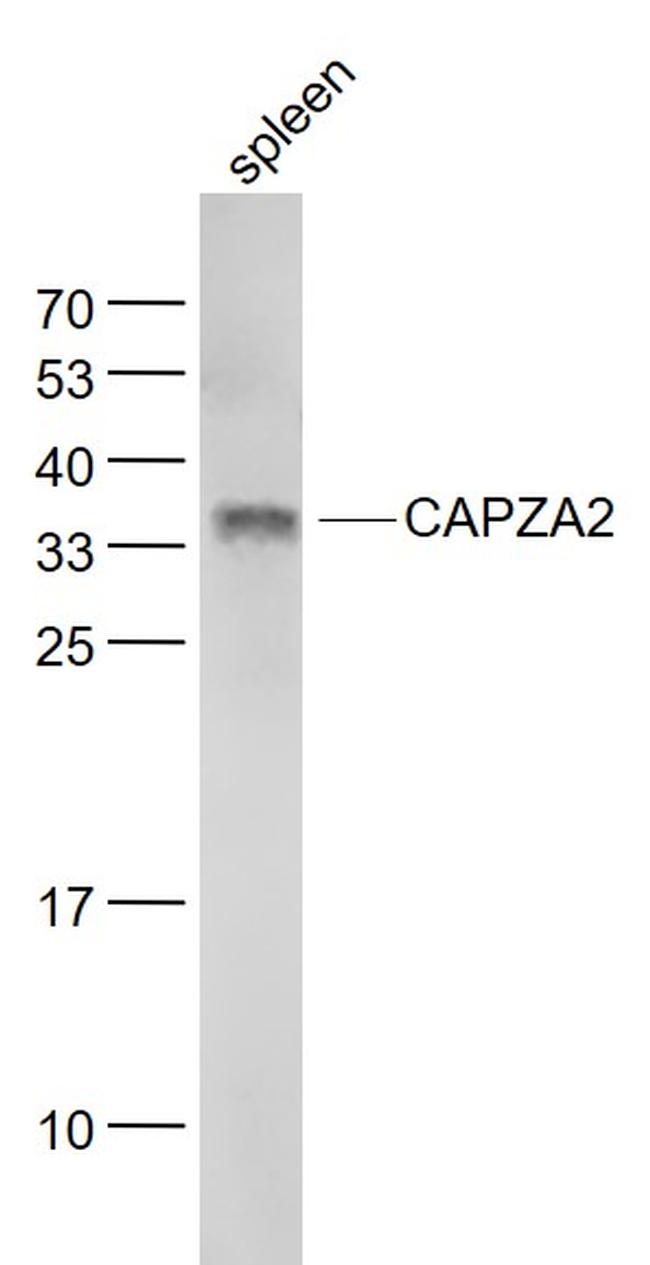 CAPZA2 Antibody in Western Blot (WB)