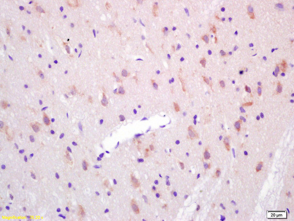 KAT2B Antibody in Immunohistochemistry (Paraffin) (IHC (P))
