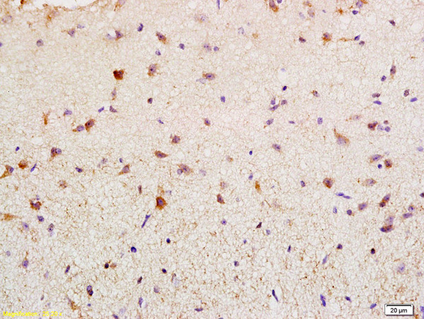 BAG2 Antibody in Immunohistochemistry (Paraffin) (IHC (P))