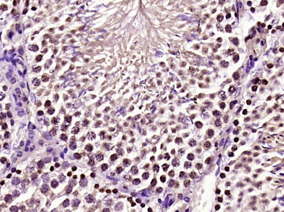 CREM Antibody in Immunohistochemistry (Paraffin) (IHC (P))