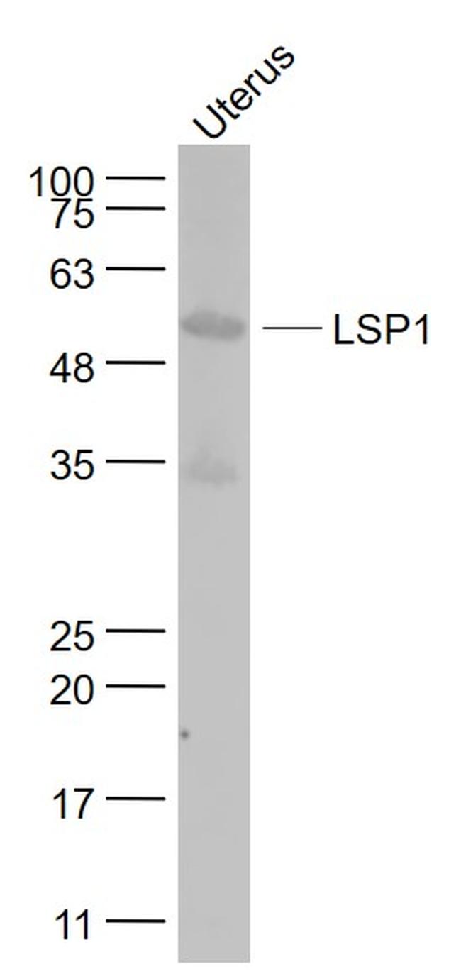 LSP1 Antibody in Western Blot (WB)