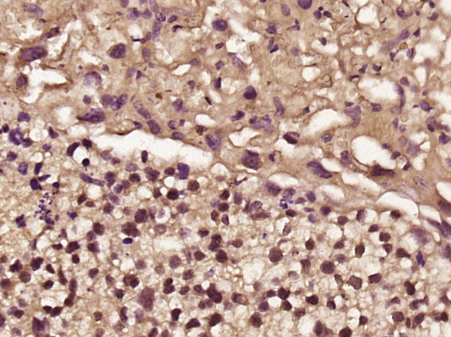 FHL2 Antibody in Immunohistochemistry (Paraffin) (IHC (P))