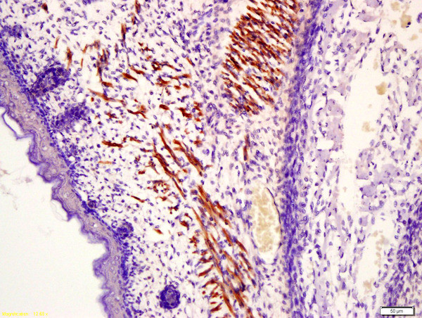 Fast skeletal Myosin Antibody in Immunohistochemistry (Paraffin) (IHC (P))