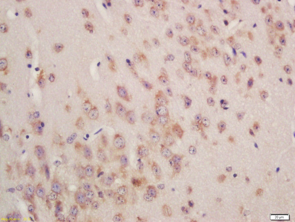 GSTA3 Antibody in Immunohistochemistry (Paraffin) (IHC (P))