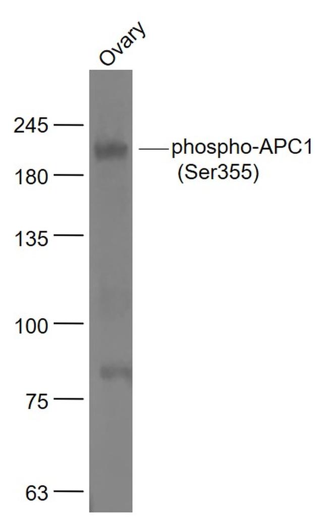 Phospho-APC1 (Ser355) Antibody in Western Blot (WB)