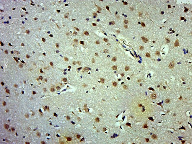 Phospho-APC1 (Ser377) Antibody in Immunohistochemistry (Paraffin) (IHC (P))