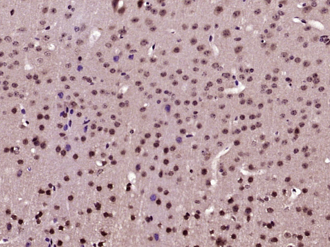 Phospho-AKT1 (Ser129) Antibody in Immunohistochemistry (Paraffin) (IHC (P))