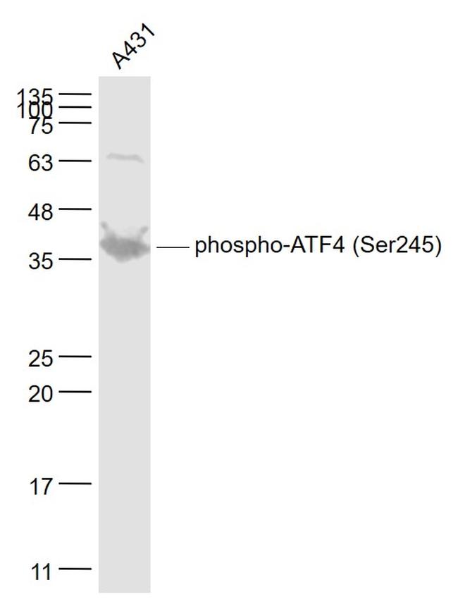 Phospho-ATF4 (Ser245) Antibody in Western Blot (WB)