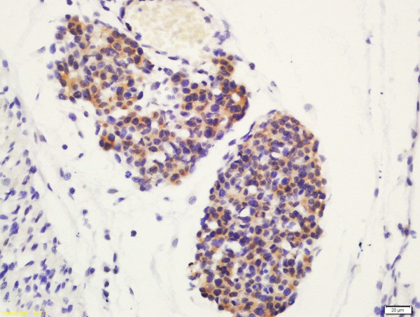 Phospho-ATG4D (Ser467) Antibody in Immunohistochemistry (Paraffin) (IHC (P))