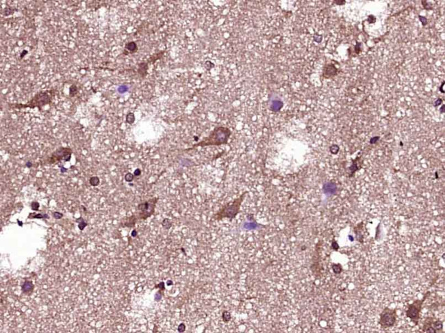 Phospho-Bad (Ser118) Antibody in Immunohistochemistry (Paraffin) (IHC (P))