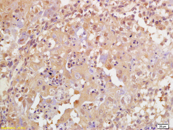 Phospho-BRCA1 (Ser1189) Antibody in Immunohistochemistry (Paraffin) (IHC (P))