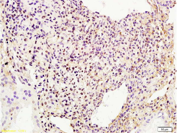 Phospho-BRIP1 (Ser990) Antibody in Immunohistochemistry (Paraffin) (IHC (P))
