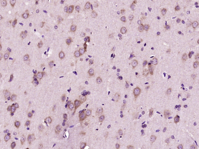 Phospho-CDKN1B (Thr187) Antibody in Immunohistochemistry (Paraffin) (IHC (P))
