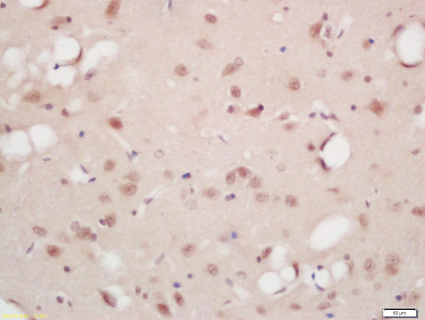 Phospho-B-Raf (Ser446) Antibody in Immunohistochemistry (Paraffin) (IHC (P))