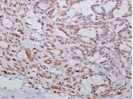 Phospho-Bcl-xL (Thr115) Antibody in Immunohistochemistry (Paraffin) (IHC (P))