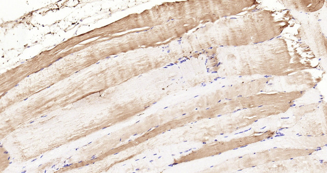 Phospho-CDKN1B  (Ser178) Antibody in Immunohistochemistry (Paraffin) (IHC (P))