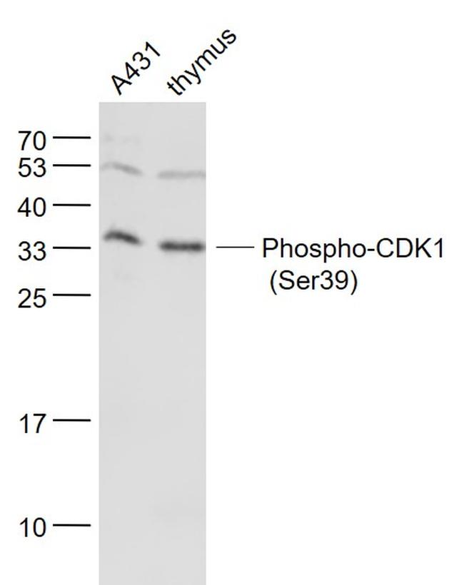 Phospho-cdc2 (Ser39) Antibody in Western Blot (WB)